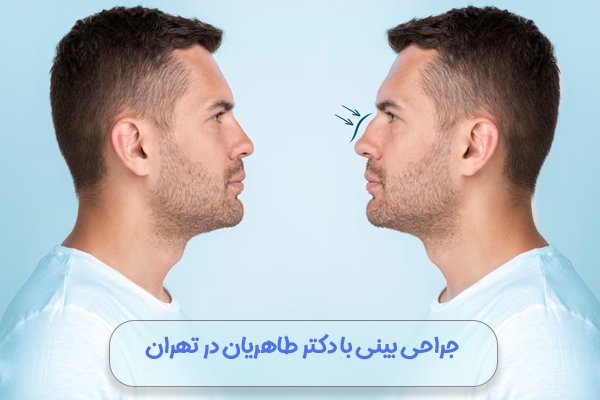 جراحی بینی با دکتر طاهریان در تهران

